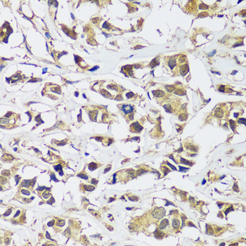 Immunohistochemistry - C12orf10 Polyclonal Antibody 