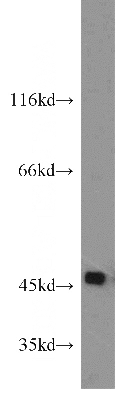 PC-3 cells were subjected to SDS PAGE followed by western blot with Catalog No:115538(SPAM1 antibody) at dilution of 1:500