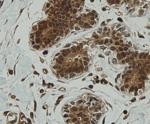 Fig8: Immunohistochemical analysis of paraffin-embedded human breast tissue using anti-CCDC51 antibody. Counter stained with hematoxylin.