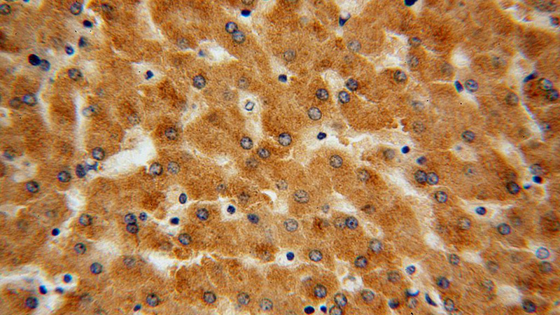 Immunohistochemical of paraffin-embedded human liver using Catalog No:116559(UGT2B7 antibody) at dilution of 1:100 (under 40x lens)