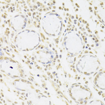 Immunohistochemistry - SNRPA Polyclonal Antibody 