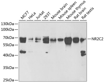 Western blot - NR2C2 Polyclonal Antibody 