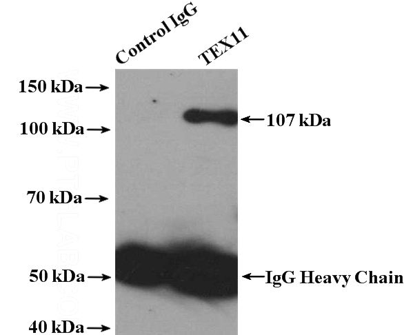 IP Result of anti-TEX11 (IP:Catalog No:115956, 4ug; Detection:Catalog No:115956 1:500) with mouse testis tissue lysate 4000ug.