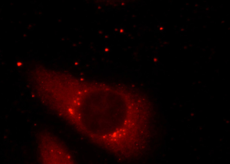 Immunofluorescent analysis of HeLa cells using Catalog No:107477(PLOD3 Antibody) at dilution of 1:25 and Rhodamine-Goat anti-Mouse IgG