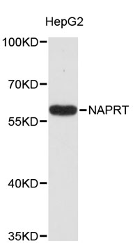 Western blot - NAPRT Polyclonal Antibody 