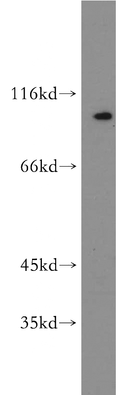 mouse spleen tissue were subjected to SDS PAGE followed by western blot with Catalog No:115200(SERPINB10 antibody) at dilution of 1:300