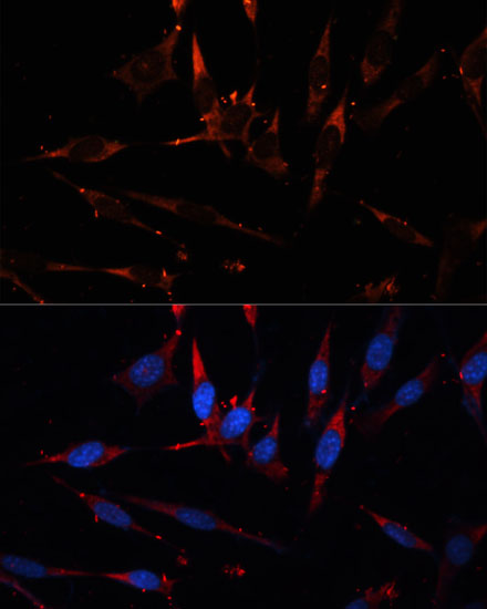 Immunofluorescence - CPT1B Polyclonal Antibody 