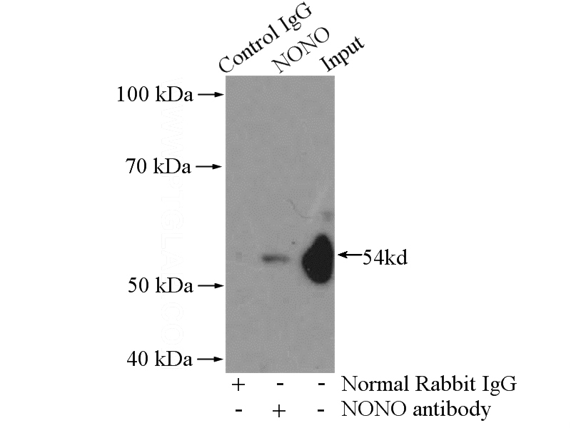 IP Result of anti-NONO (IP:Catalog No:113302, 4ug; Detection:Catalog No:113302 1:1000) with HEK-293 cells lysate 2800ug.