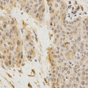 Immunohistochemistry - GGA2 Polyclonal Antibody 