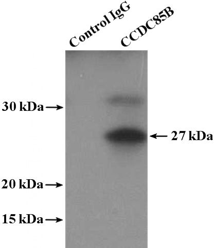 IP Result of anti-CCDC85B (IP:Catalog No:108990, 4ug; Detection:Catalog No:108990 1:300) with mouse heart tissue lysate 3600ug.