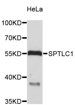 Western blot - SPTLC1 Polyclonal Antibody 
