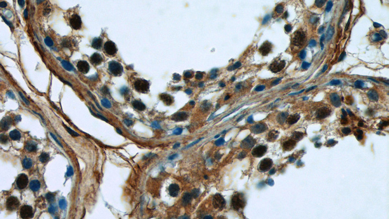 Immunohistochemistry of paraffin-embedded human testis tissue slide using Catalog No:112053(KIFC1 Antibody) at dilution of 1:50 (under 40x lens)