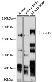 Western blot - XPO6 Polyclonal Antibody 