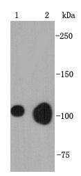 Fig1: Western blot analysis on mouse ovaries (1) and SKOV3 (2) lysates using anti-BNC1 rabbit polyclonal antibodies.