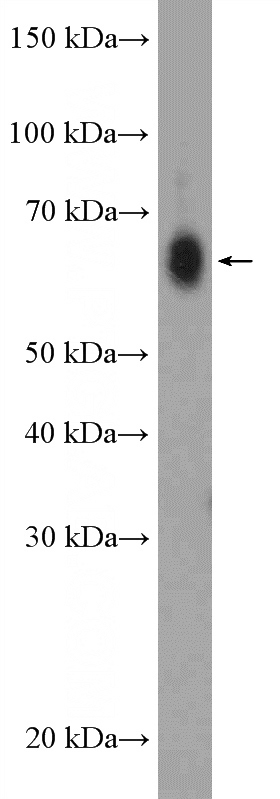 PC-3 cells were subjected to SDS PAGE followed by western blot with Catalog No:116935(ZCCHC7 Antibody) at dilution of 1:300
