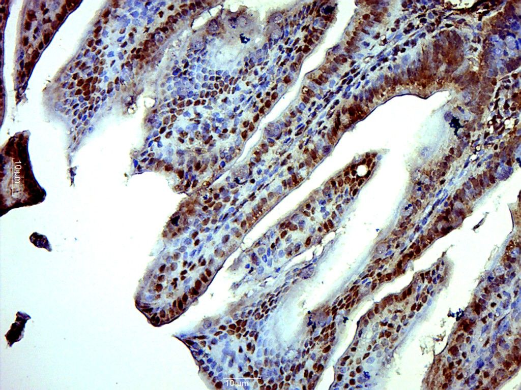Fig1: Paraformaldehyde-fixed, paraffin embedded (Mouse small intestine); Antigen retrieval by boiling in sodium citrate buffer (pH6.0) for 15min; Block endogenous peroxidase by 3% hydrogen peroxide for 20 minutes; Blocking buffer (normal goat serum) at 37℃ for 30min; Antibody incubation with (ISX) Polyclonal Antibody, Unconjugated at 1:500 overnight at 4℃, followed by a conjugated secondary (sp-0023) for 20 minutes and DAB staining.
