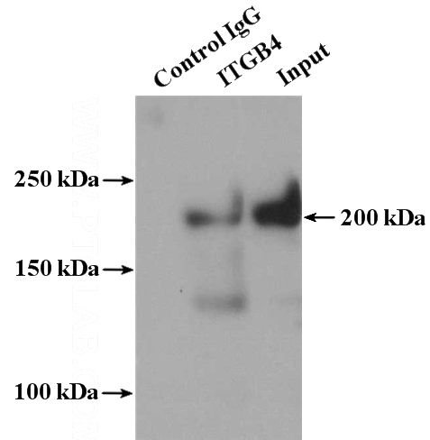 IP Result of anti-Integrin beta-4 (IP:Catalog No:111864, 4ug; Detection:Catalog No:111864 1:500) with HeLa cells lysate 2400ug.