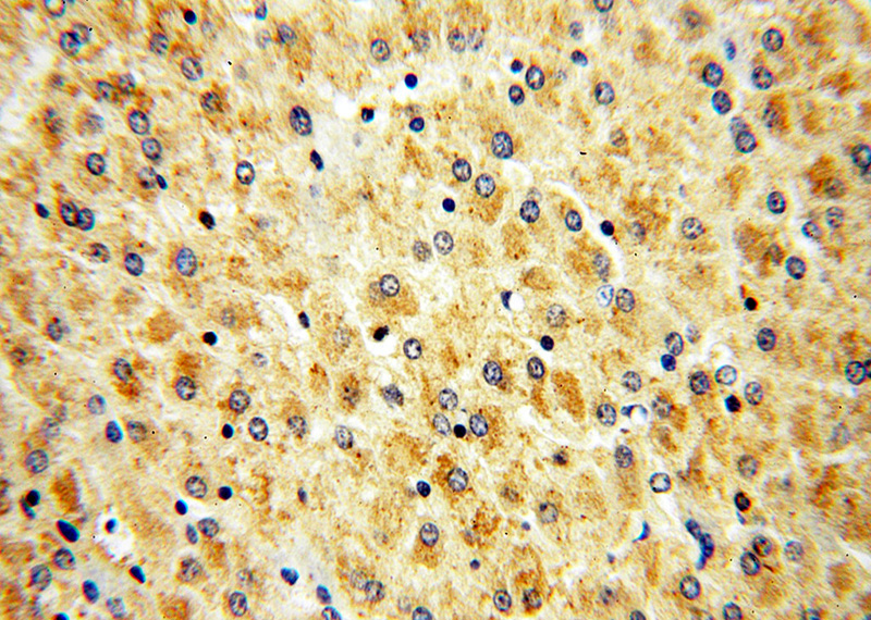 Immunohistochemical of paraffin-embedded human liver using Catalog No:112264(LACTB antibody) at dilution of 1:100 (under 40x lens)