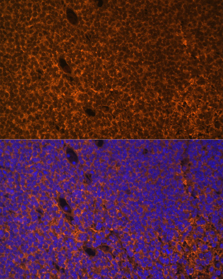 Immunofluorescence - PTCH1 Polyclonal Antibody 