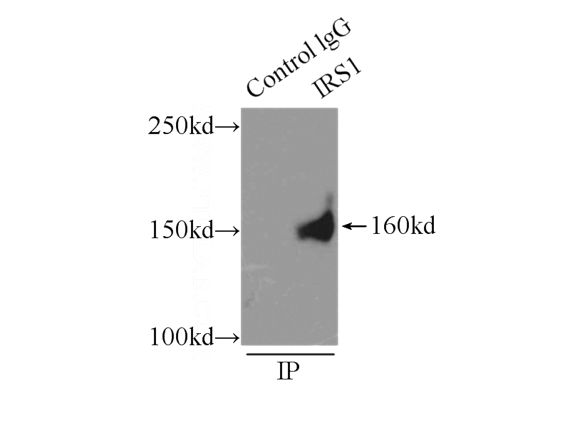 IP Result of anti-IRS1 (IP:Catalog No:111933, 5ug; Detection:Catalog No:111933 1:1000) with A549 cells lysate 3500ug.