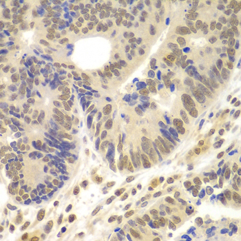 Immunohistochemistry - LHX4 Polyclonal Antibody 