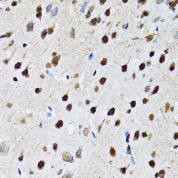 Immunohistochemistry - CCAR2 Polyclonal Antibody 