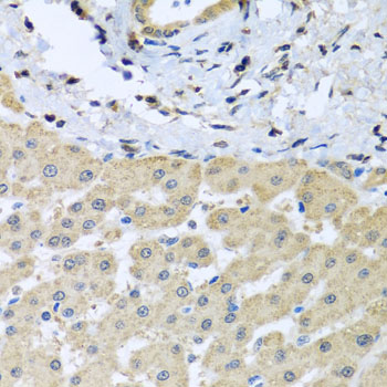 Immunohistochemistry - LETMD1 Polyclonal Antibody 