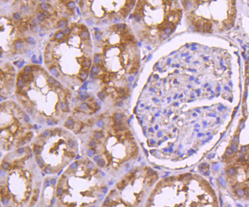 Fig5: Immunohistochemical analysis of paraffin-embedded human kidney tissue using anti-Osteoprotegerin antibody. Counter stained with hematoxylin.