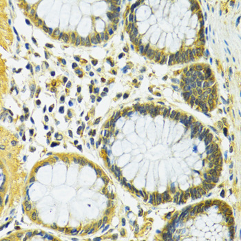 Immunohistochemistry - SLC25A1 Polyclonal Antibody 