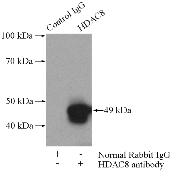 IP Result of anti-HDAC8 (IP:Catalog No:111383, 4ug; Detection:Catalog No:111383 1:600) with Raji cells lysate 2800ug.