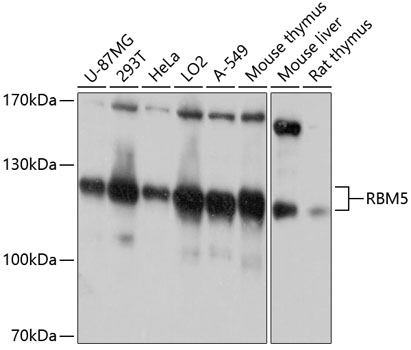 Western blot - RBM5 Polyclonal Antibody 