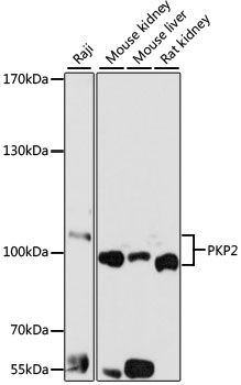 Western blot - PKP2 Polyclonal Antibody 