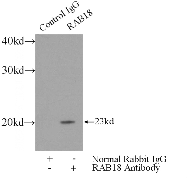 IP Result of anti-RAB18 (IP:Catalog No:114415, 3ug; Detection:Catalog No:114415 1:300) with mouse testis tissue lysate 4000ug.