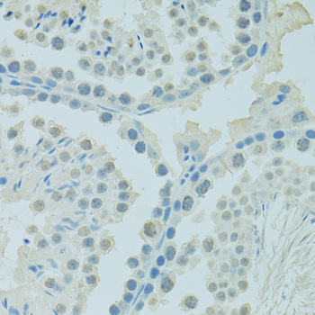 Immunohistochemistry - PSIP1 Polyclonal Antibody 
