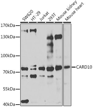 Western blot - CARD10 Polyclonal Antibody 