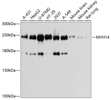 Western blot - MYH14 Polyclonal Antibody 