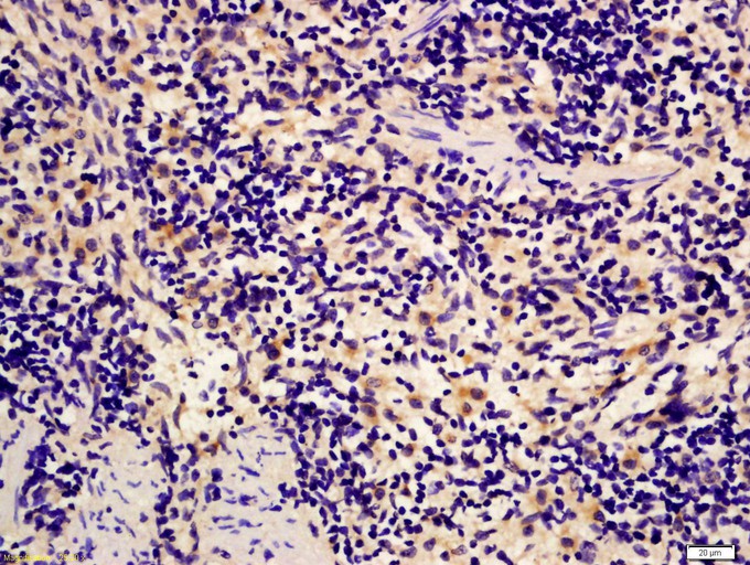 Fig1: Tissue/cell: Rat spleen tissue; 4% Paraformaldehyde-fixed and paraffin-embedded;; Antigen retrieval: citrate buffer ( 0.01M, pH 6.0 ), Boiling bathing for 15min; Block endogenous peroxidase by 3% Hydrogen peroxide for 30min; Blocking buffer (normal goat serum,C-0005) at 37℃ for 20 min;; Incubation: Anti-IGFBP4 Polyclonal Antibody, Unconjugated 1:200, overnight at 4℃, followed by conjugation to the secondary antibody (SP-0023) and DAB (C-0010) staining