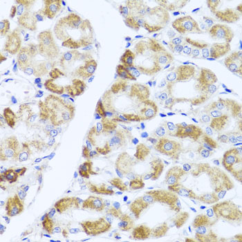 Immunohistochemistry - PIK3CA Polyclonal Antibody 