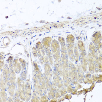 Immunohistochemistry - IRS2 Polyclonal Antibody 