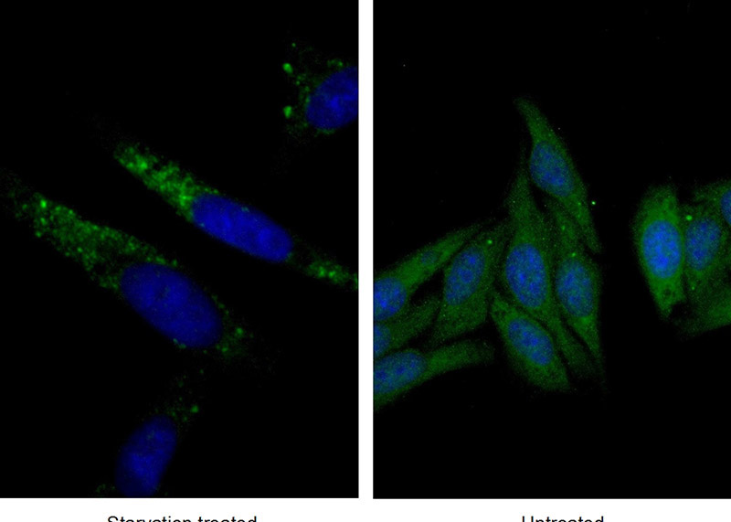 Immunofluorescent analysis of (-20oc Ethanol) fixed Starvation treated HepG2 cells using Catalog No:110770(GABARAP Antibody) at dilution of 1:50 and Alexa Fluor 488-congugated AffiniPure Goat Anti-Rabbit IgG(H+L)