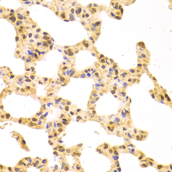 Immunohistochemistry - SRSF1 Polyclonal Antibody 