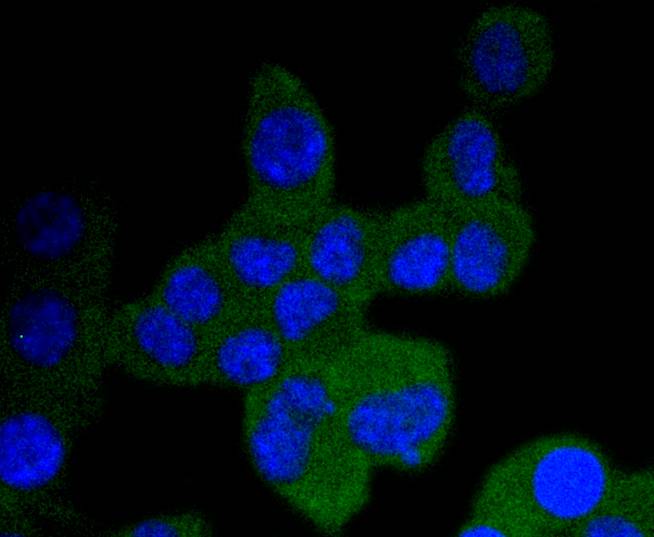 Fig2: ICC staining TrkA+B+C in N2A cells (green). The nuclear counter stain is DAPI (blue). Cells were fixed in paraformaldehyde, permeabilised with 0.25% Triton X100/PBS.