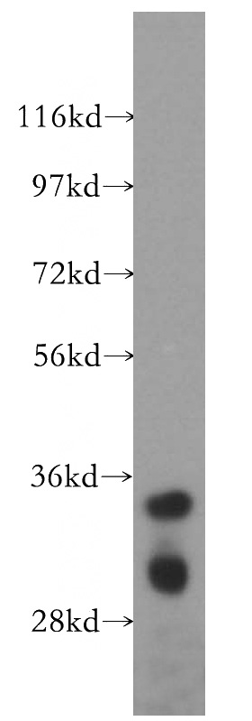mouse thymus tissue were subjected to SDS PAGE followed by western blot with Catalog No:109942(DIMT1L antibody) at dilution of 1:500