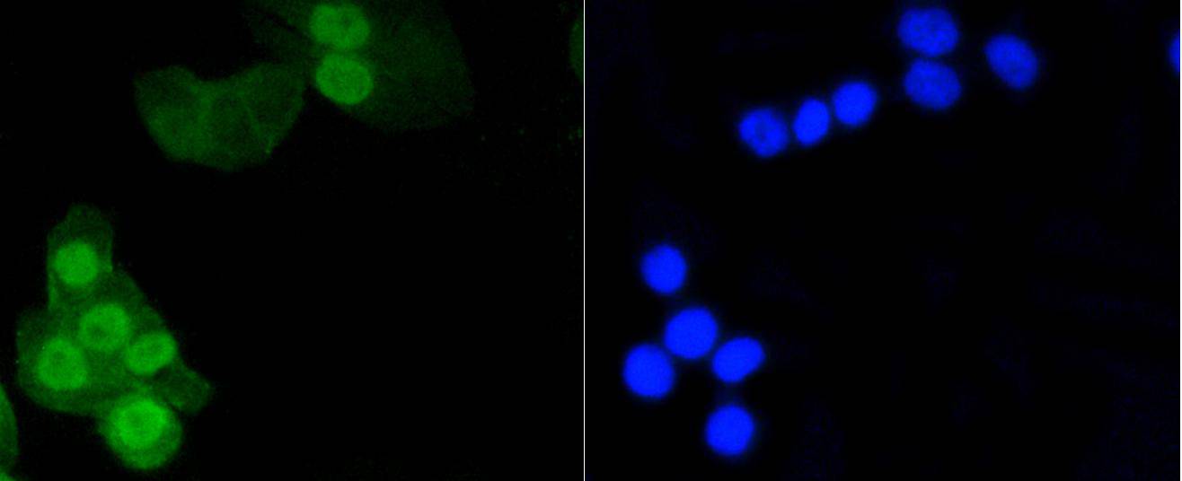 Fig3:; ICC staining of Phospho-Histone H1.3(T17)+Histone H1.4(T17) in CRC cells (green). Formalin fixed cells were permeabilized with 0.1% Triton X-100 in TBS for 10 minutes at room temperature and blocked with 1% Blocker BSA for 15 minutes at room temperature. Cells were probed with the primary antibody ( 1/50) for 1 hour at room temperature, washed with PBS. Alexa Fluor®488 Goat anti-Rabbit IgG was used as the secondary antibody at 1/1,000 dilution. The nuclear counter stain is DAPI (blue).