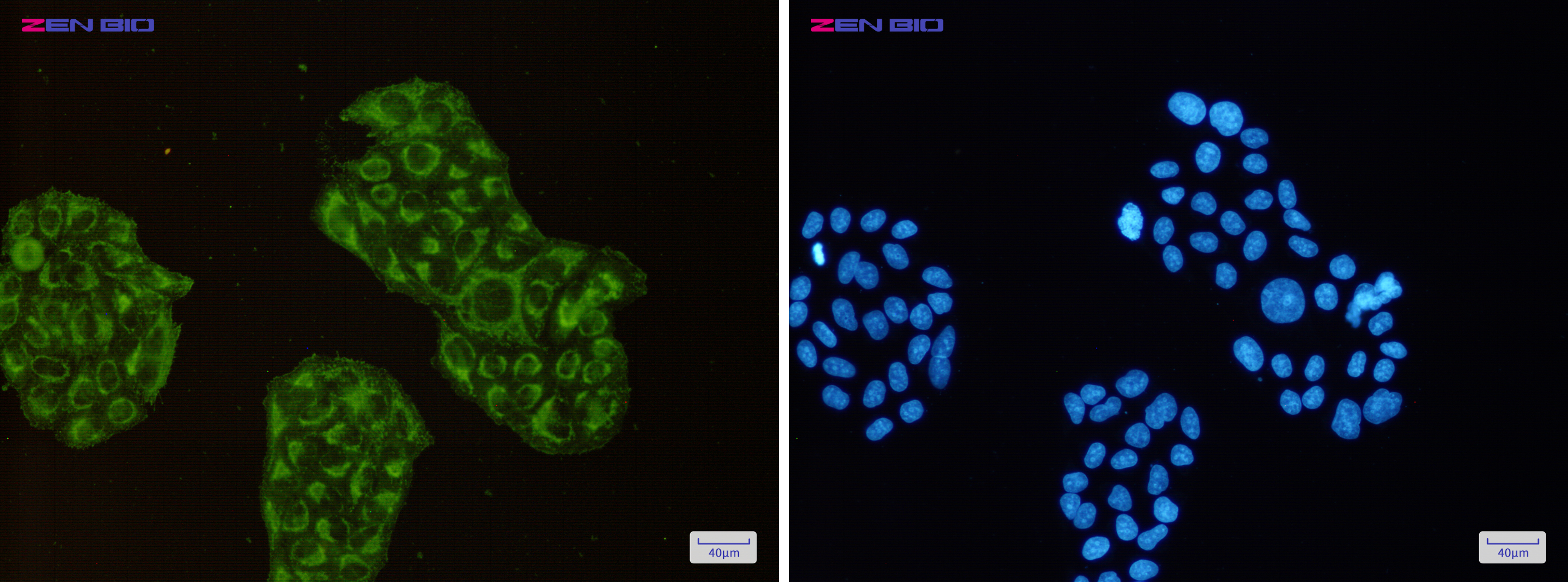 Immunocytochemistry of ACADM(green) in Hela cells using ACADM Rabbit pAb at dilution 1/50, and DAPI(blue)