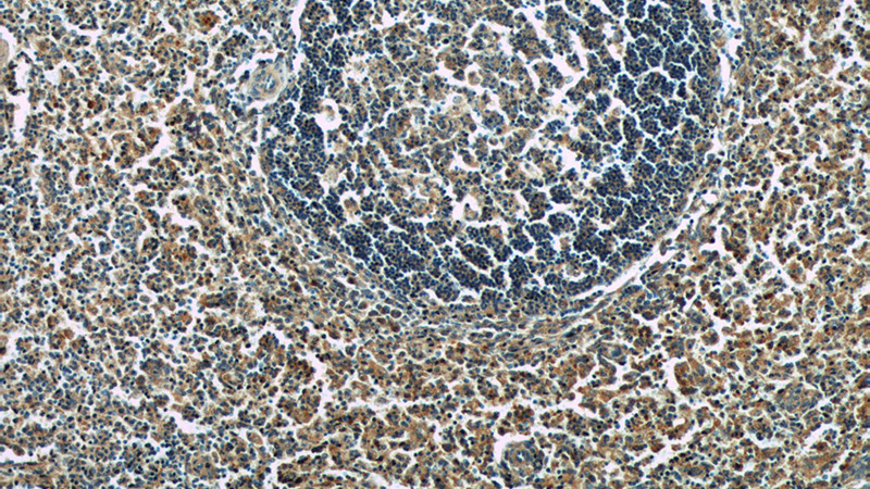 Immunohistochemistry of paraffin-embedded human spleen tissue slide using Catalog No:115255(SKAP55,SKAP1 Antibody) at dilution of 1:50 (under 10x lens)