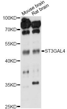 Western blot - ST3GAL4 Polyclonal Antibody 