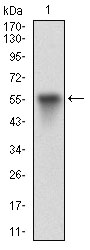 Fig1: Western blot analysis of VTN on human VTN recombinant protein using anti-VTN antibody at 1/1,000 dilution.