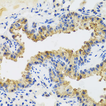 Immunohistochemistry - UVRAG Polyclonal Antibody 
