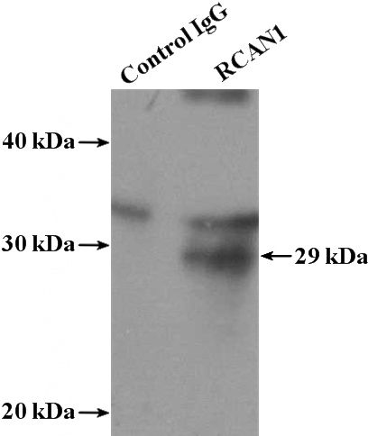 IP Result of anti-RCAN1 (IP:Catalog No:114570, 4ug; Detection:Catalog No:114570 1:500) with mouse brain tissue lysate 4000ug.